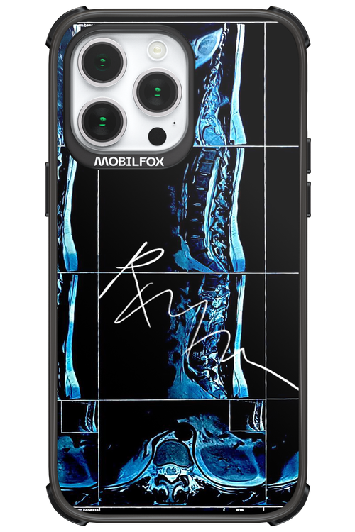 RMN Scolioza 2.0 - Apple iPhone 14 Pro Max