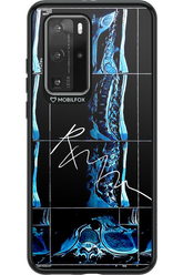 RMN Scolioza 2.0 - Huawei P40 Pro