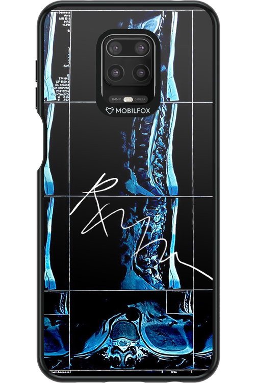 RMN Scolioza 2.0 - Xiaomi Redmi Note 9 Pro
