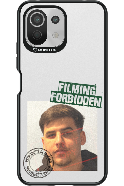 Sorin Mugshot 2.0 - Xiaomi Mi 11 Lite (2021)