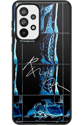 RMN Scolioza 2.0 - Samsung Galaxy A73