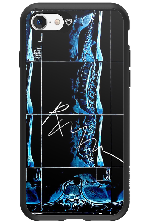 RMN Scolioza 2.0 - Apple iPhone 7