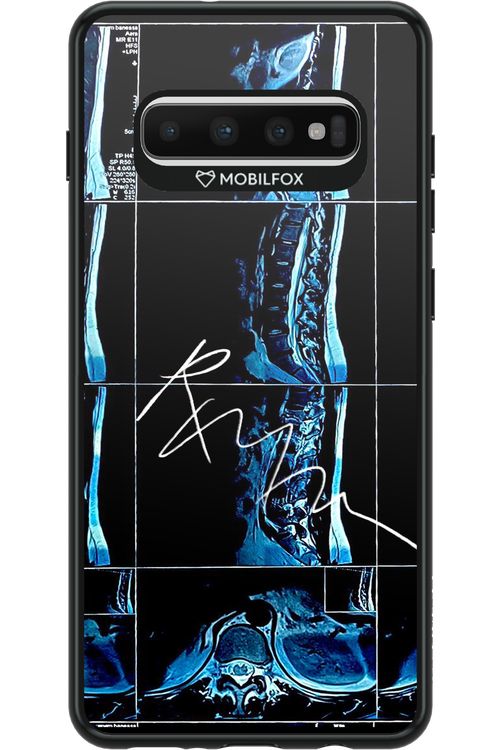 RMN Scolioza 2.0 - Samsung Galaxy S10+