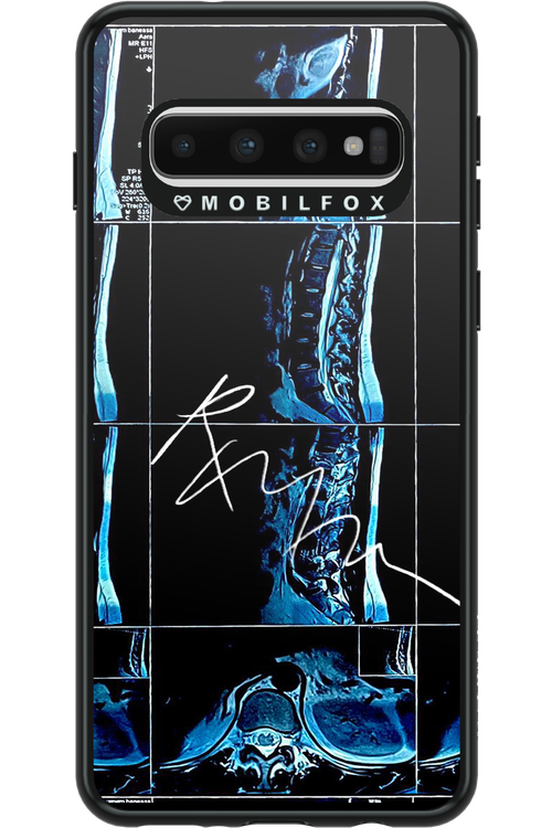 RMN Scolioza 2.0 - Samsung Galaxy S10