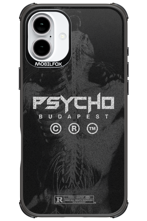 X-Ray - Apple iPhone 16 Plus