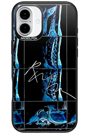 RMN Scolioza 2.0 - Apple iPhone 16 Plus