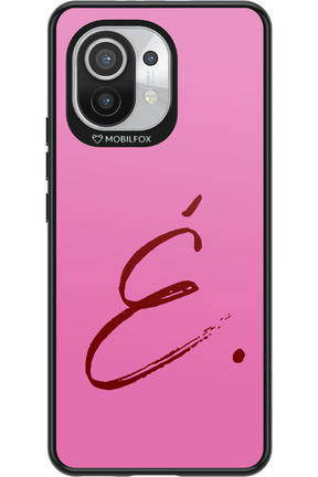 (Sorbet) E II 2.0 - Xiaomi Mi 11 5G