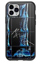 RMN Scolioza 2.0 - Apple iPhone 11 Pro