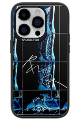 RMN Scolioza 2.0 - Apple iPhone 14 Pro
