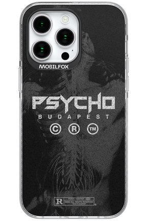 X-Ray - Apple iPhone 15 Pro Max