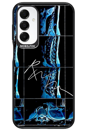 RMN Scolioza 2.0 - Samsung A16