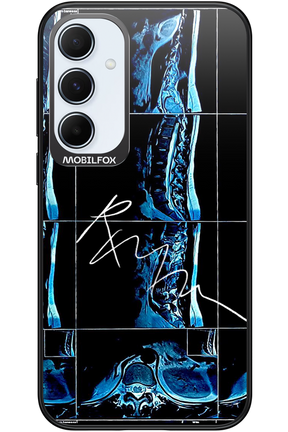 RMN Scolioza 2.0 - Samsung Galaxy A55