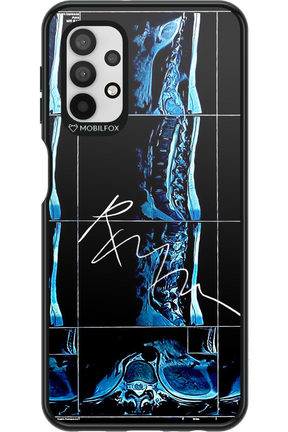 RMN Scolioza 2.0 - Samsung Galaxy A32 5G