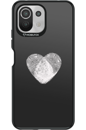 EVIDENCE - Xiaomi Mi 11 Lite (2021)