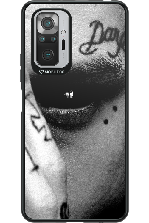 Eye On You - Xiaomi Redmi Note 10S