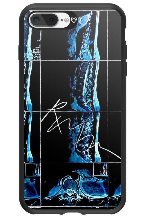RMN Scolioza 2.0 - Apple iPhone 7 Plus
