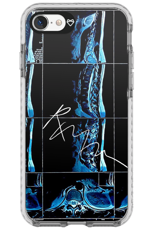 RMN Scolioza 2.0 - Apple iPhone 7