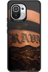 Dark Lace 2.0 - Xiaomi Mi 11 5G