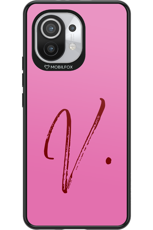(Sorbet) V 2.0 - Xiaomi Mi 11 5G