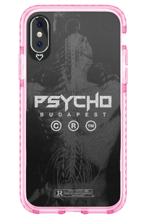 X-Ray - Apple iPhone X