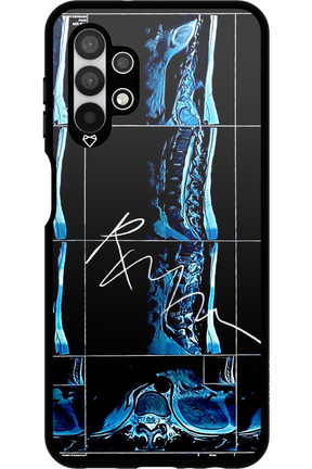 RMN Scolioza 2.0 - Samsung Galaxy A13 4G