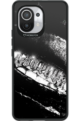 Grillz Black Centaur 2.0 - Xiaomi Mi 11 5G
