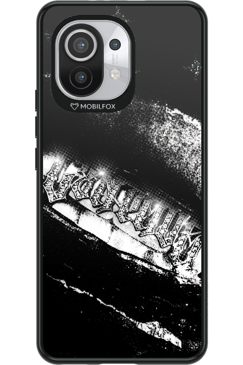 Grillz Black Centaur 2.0 - Xiaomi Mi 11 5G