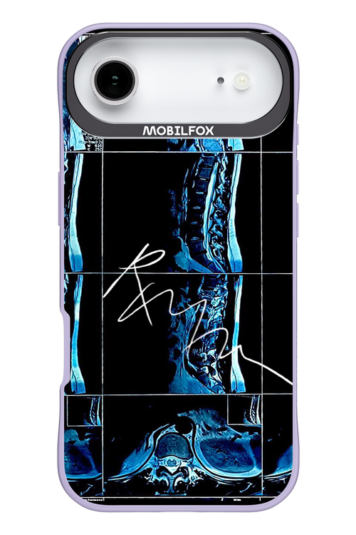 RMN Scolioza 2.0 - Apple iPhone 17 Air