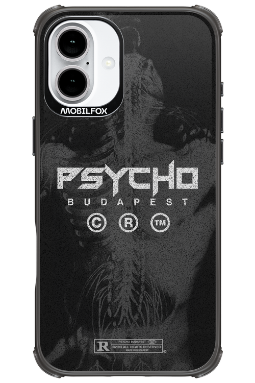 X-Ray - Apple iPhone 16 Plus