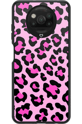 PINK LEOPARD 2.0 - Xiaomi Poco X3 Pro