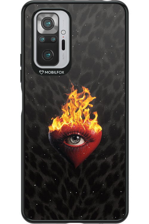 Shit happens - Xiaomi Redmi Note 10 Pro