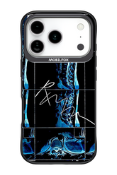 RMN Scolioza 2.0 - Apple iPhone 17 Pro