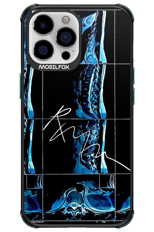 RMN Scolioza 2.0 - Apple iPhone 13 Pro Max