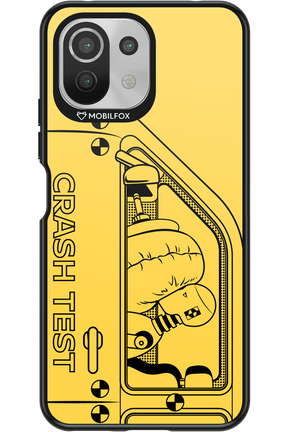 Crumple Zone - Xiaomi Mi 11 Lite (2021)