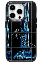 RMN Scolioza 2.0 - Apple iPhone 15 Pro
