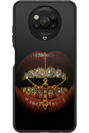 Greedy 2.0 - Xiaomi Poco X3 NFC