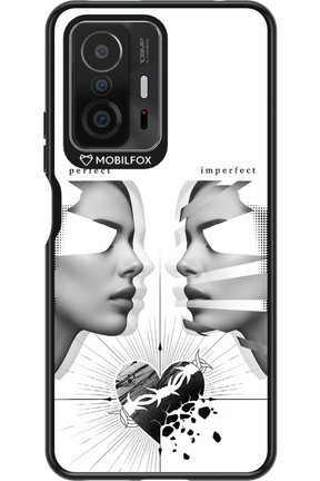 Arcok 2.0 - Xiaomi Mi 11T
