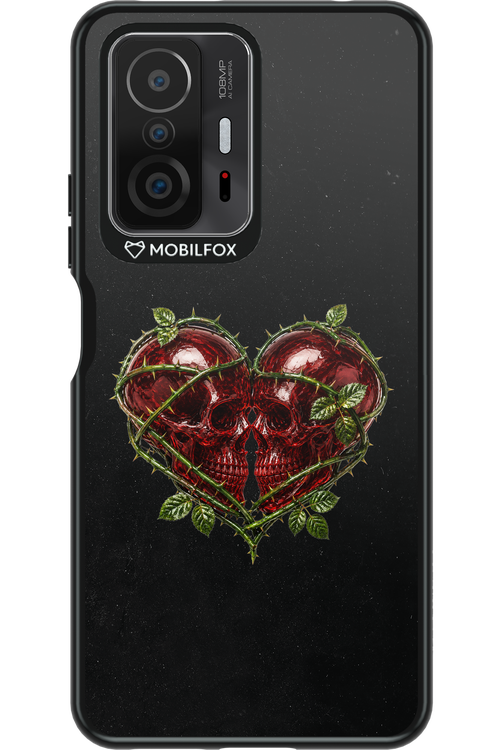 Omen Kiss 2.0 - Xiaomi Mi 11T Pro