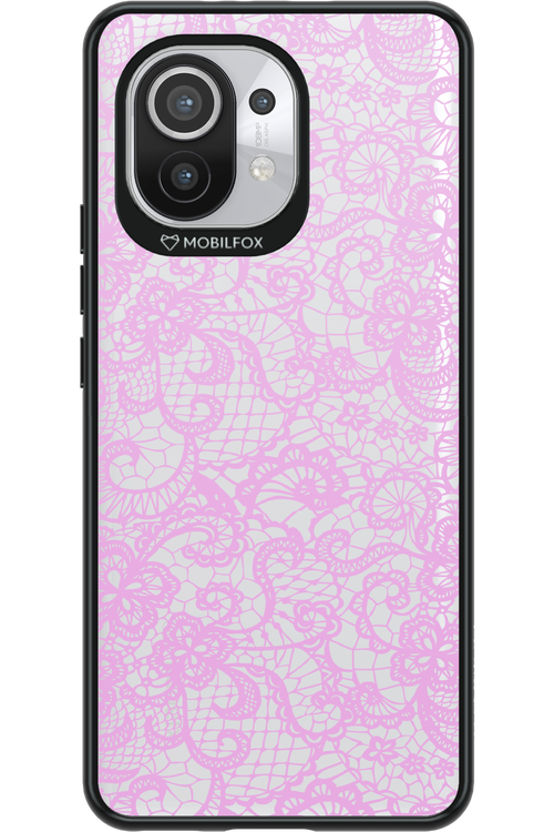 Dantela 2.0 - Xiaomi Mi 11 5G
