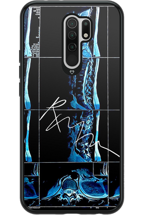 RMN Scolioza 2.0 - Xiaomi Redmi 9