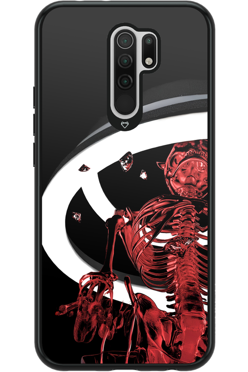 RMN Skeleton - Xiaomi Redmi 9