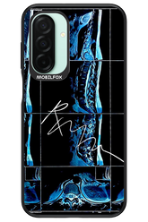 RMN Scolioza 2.0 - Samsung Galaxy A26