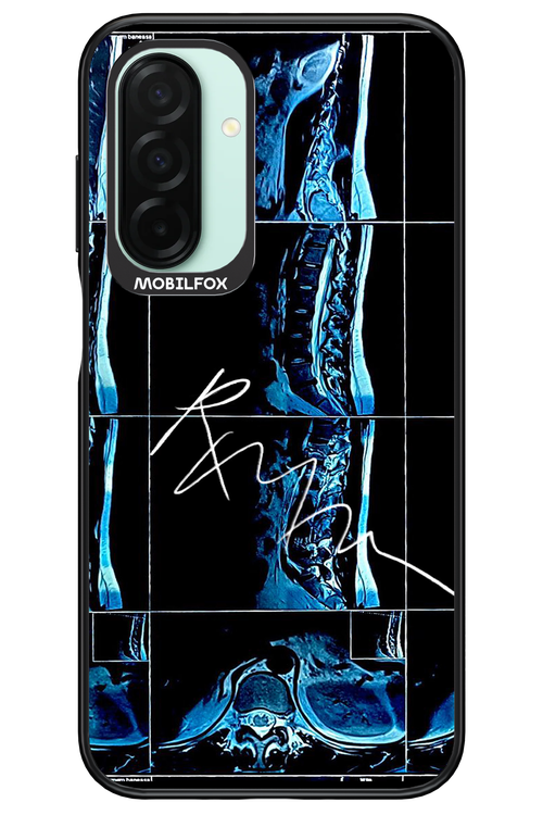 RMN Scolioza 2.0 - Samsung Galaxy A26