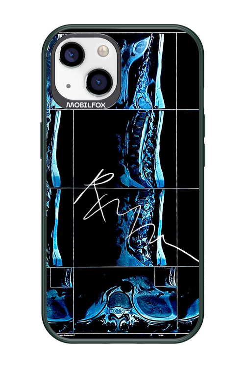 RMN Scolioza 2.0 - Apple iPhone 13