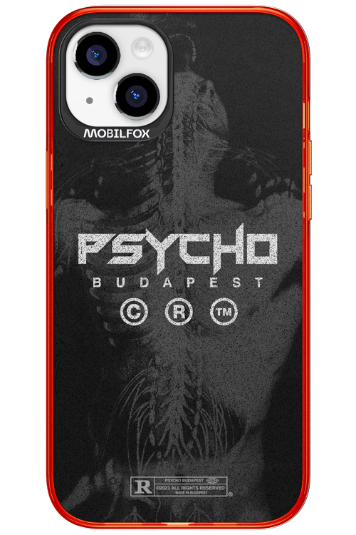 X-Ray - Apple iPhone 15 Plus