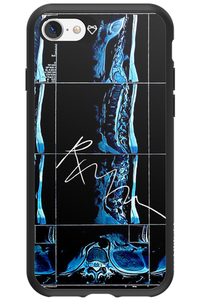 RMN Scolioza 2.0 - Apple iPhone 7
