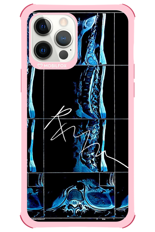 RMN Scolioza 2.0 - Apple iPhone 12 Pro Max