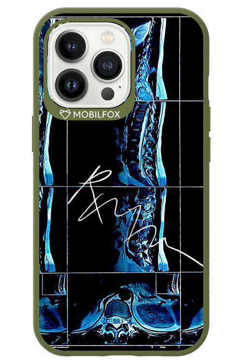 RMN Scolioza 2.0 - Apple iPhone 13 Pro