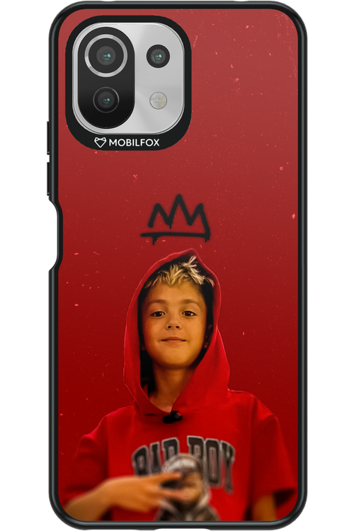 Small King - Xiaomi Mi 11 Lite (2021)