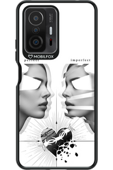 Arcok 2.0 - Xiaomi Mi 11T Pro
